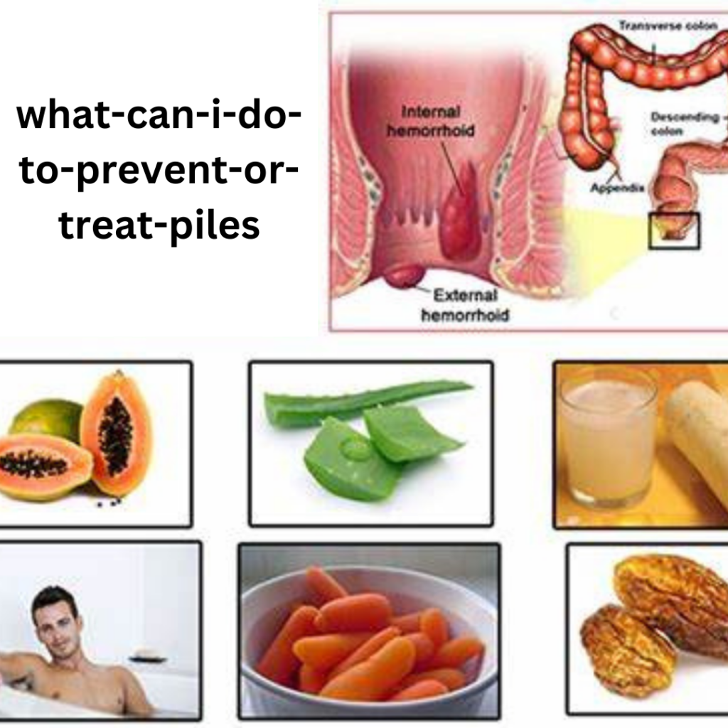 what-can-i-do-to-prevent-or-treat-piles